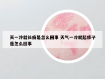 天一冷就长癣是怎么回事 天气一冷就起疹子是怎么回事