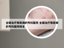 全国治疗银屑病的专科医院 全国治疗银屑病的专科医院排名