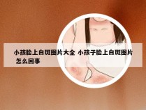 小孩脸上白斑图片大全 小孩子脸上白斑图片 怎么回事