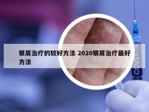 银屑治疗的较好方法 2020银屑治疗最好方法