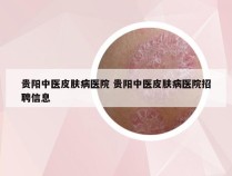 贵阳中医皮肤病医院 贵阳中医皮肤病医院招聘信息