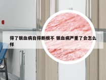 得了银血病自得断根不 银血病严重了会怎么样