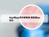 fpga和pga评分银屑病 银屑病iga评分