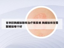 甘利欣胸腺肽联和治疗银屑病 胸腺肽和甘露聚糖肽哪个好