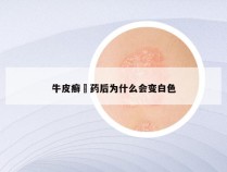 牛皮癣抺药后为什么会变白色