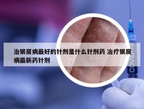 治银屑病最好的针剂是什么针剂药 冶疗银屑病最新药针剂