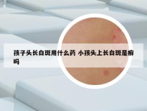 孩子头长白斑用什么药 小孩头上长白斑是癣吗