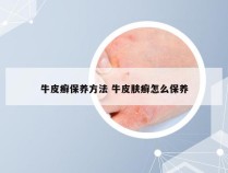 牛皮癣保养方法 牛皮肤癣怎么保养