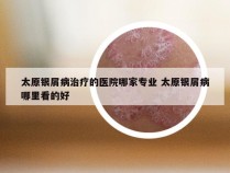 太原银屑病治疗的医院哪家专业 太原银屑病哪里看的好