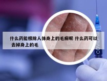 什么药能根除人体身上的毛癣呢 什么药可以 去掉身上的毛