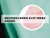 婚后才知道老公有银屑病 老公得了银屑病会影响生育吗