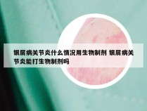 银屑病关节炎什么情况用生物制剂 银屑病关节炎能打生物制剂吗