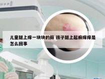 儿童腿上痒一块块的藓 孩子腿上起癣痒痒是怎么回事