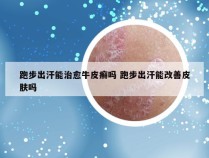 跑步出汗能治愈牛皮癣吗 跑步出汗能改善皮肤吗