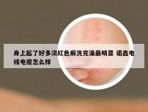 身上起了好多淡红色癣洗完澡最明显 诺鑫电线电缆怎么样