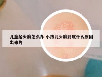 儿童起头癣怎么办 小孩儿头癣到底什么原因出来的