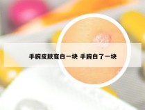 手腕皮肤变白一块 手腕白了一块