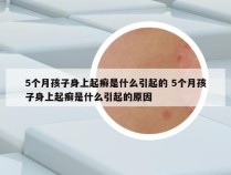 5个月孩子身上起癣是什么引起的 5个月孩子身上起癣是什么引起的原因