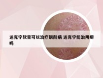 达克宁软膏可以治疗银削病 达克宁能治阴癣吗