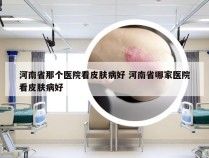 河南省那个医院看皮肤病好 河南省哪家医院看皮肤病好