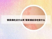 银屑病吃点什么呢 银屑病应该吃些什么