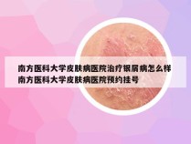 南方医科大学皮肤病医院治疗银屑病怎么样 南方医科大学皮肤病医院预约挂号