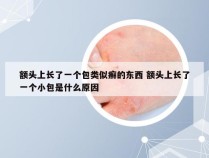 额头上长了一个包类似癣的东西 额头上长了一个小包是什么原因