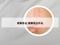 皮藓忌口 皮藓忌口什么