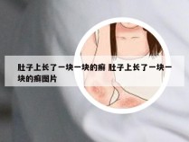 肚子上长了一块一块的癣 肚子上长了一块一块的癣图片