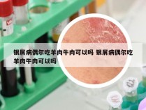 银屑病偶尔吃羊肉牛肉可以吗 银屑病偶尔吃羊肉牛肉可以吗