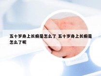 五十岁身上长癣是怎么了 五十岁身上长癣是怎么了呢