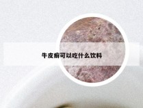 牛皮癣可以吃什么饮料