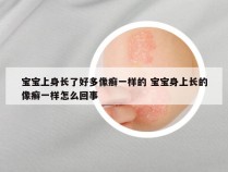 宝宝上身长了好多像癣一样的 宝宝身上长的像癣一样怎么回事