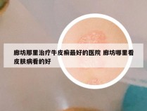 廊坊那里治疗牛皮癣最好的医院 廊坊哪里看皮肤病看的好