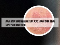 郑州银屑病研究所高效周文敬 郑州市银屑病研究所周文静医生