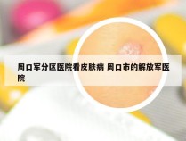 周口军分区医院看皮肤病 周口市的解放军医院