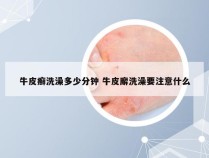 牛皮癣洗澡多少分钟 牛皮廨洗澡要注意什么