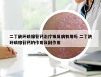 二丁酰环磷腺苷钙治疗银屑病有用吗 二丁酰环磷腺苷钙的作用及副作用