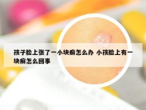 孩子脸上张了一小块癣怎么办 小孩脸上有一块癣怎么回事