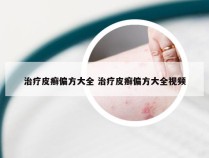 治疗皮癣偏方大全 治疗皮癣偏方大全视频