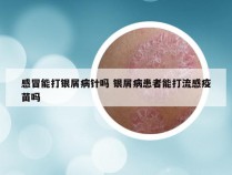 感冒能打银屑病针吗 银屑病患者能打流感疫苗吗