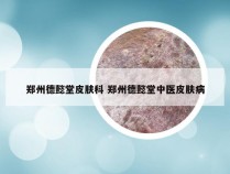 郑州德懿堂皮肤科 郑州德懿堂中医皮肤病