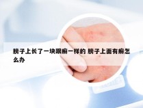 膀子上长了一块跟癣一样的 膀子上面有癣怎么办