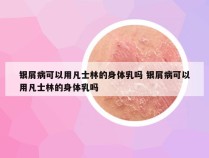 银屑病可以用凡士林的身体乳吗 银屑病可以用凡士林的身体乳吗