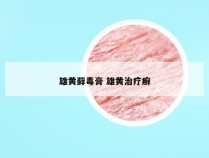 雄黄藓毒膏 雄黄治疗癣