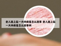 老人腿上起一大块癣是怎么回事 老人腿上起一大块癣是怎么回事啊