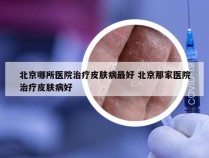 北京哪所医院治疗皮肤病最好 北京那家医院治疗皮肤病好