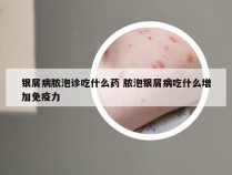 银屑病脓泡诊吃什么药 脓泡银屑病吃什么增加免疫力