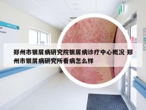 郑州市银屑病研究院银屑病诊疗中心概况 郑州市银屑病研究所看病怎么样