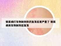 银屑病打生物制剂停药复发后更严重了 银屑病用生物制剂后复发